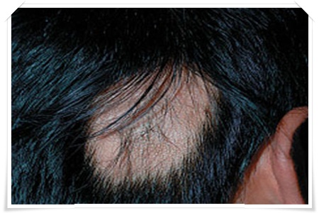 a8fro.jpg